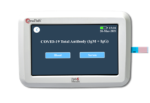 Electrochemical ELISA test would help accurate estimation of total antibody concentration of COVID- 19